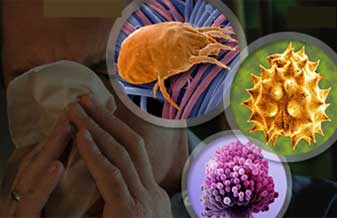 Immunitas Alergia e Imunologia Clinica - Foto 1